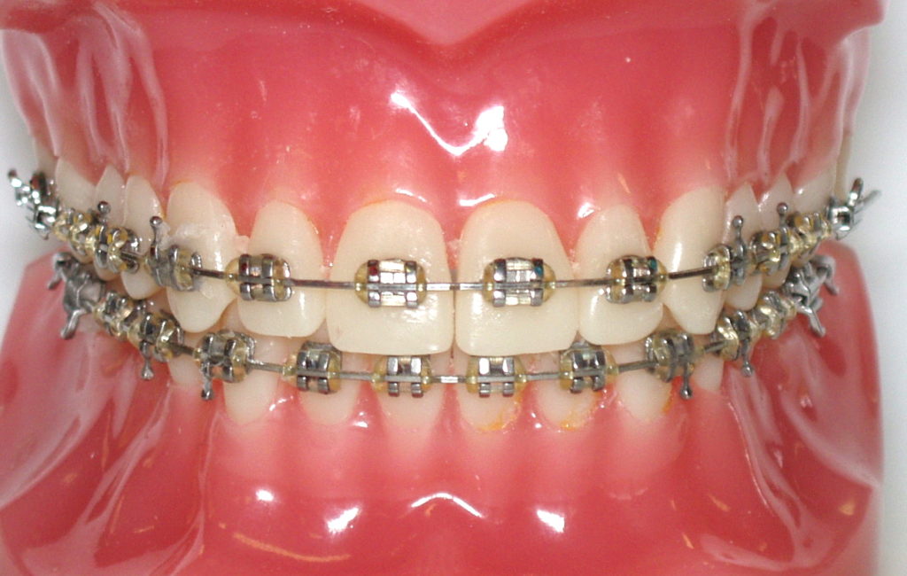 Orthodontic Dental Assistant