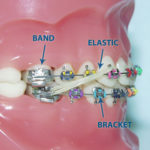 orthodontic dental assistant procedures