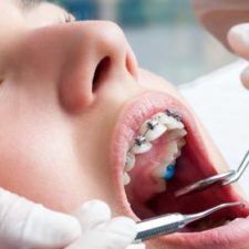 6 Week Orthodontic Dental Assistant Training Course
