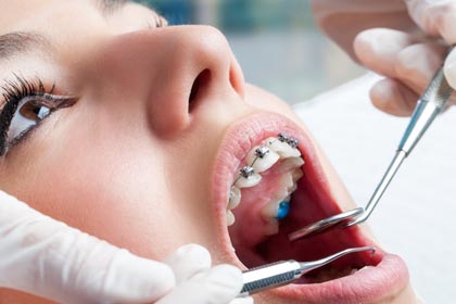 Orthodontic Dental Assistant Course