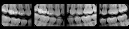 Dental X-ray Certification