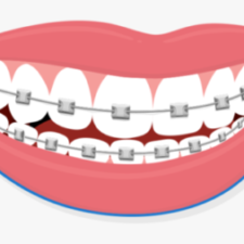 Orthodontic Dental Assistant Program