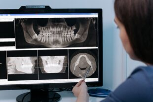 Dentist looking at a dental x-ray